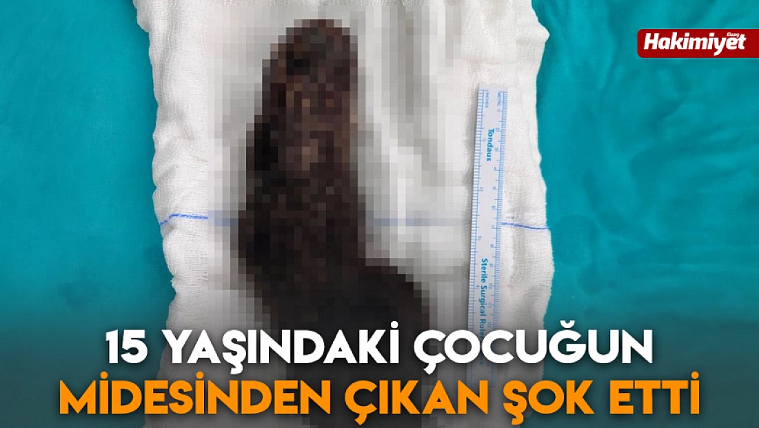 15 yaşındaki çocuğun midesinden çıkan şok etti