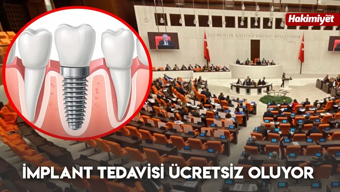 İmplant tedavisi ücretsiz oluyor