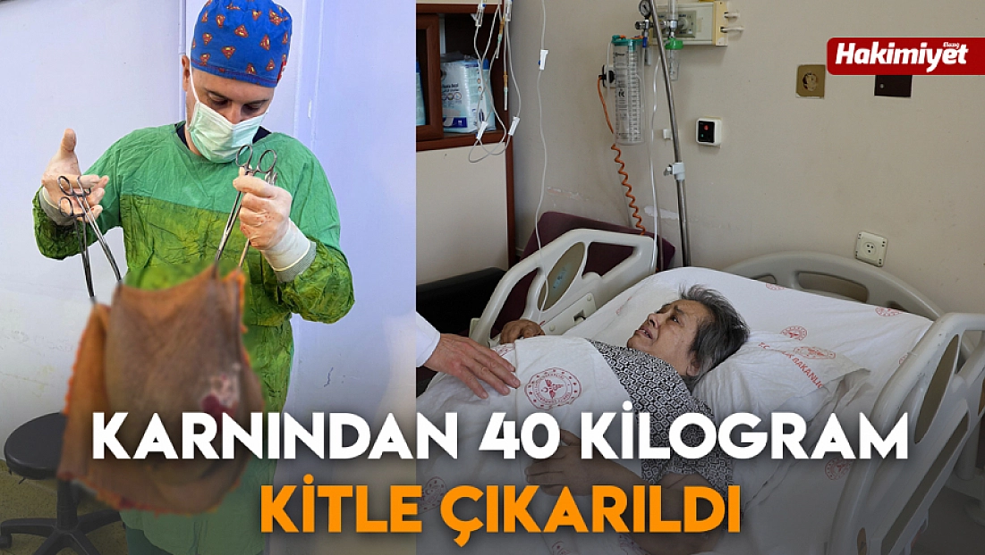 Karnından 40 kilogram kitle çıkarıldı