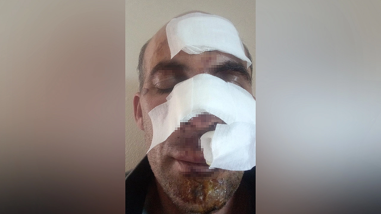 Elazığ'da skandal: Eniştesine araçla çarpıp kaçtı!