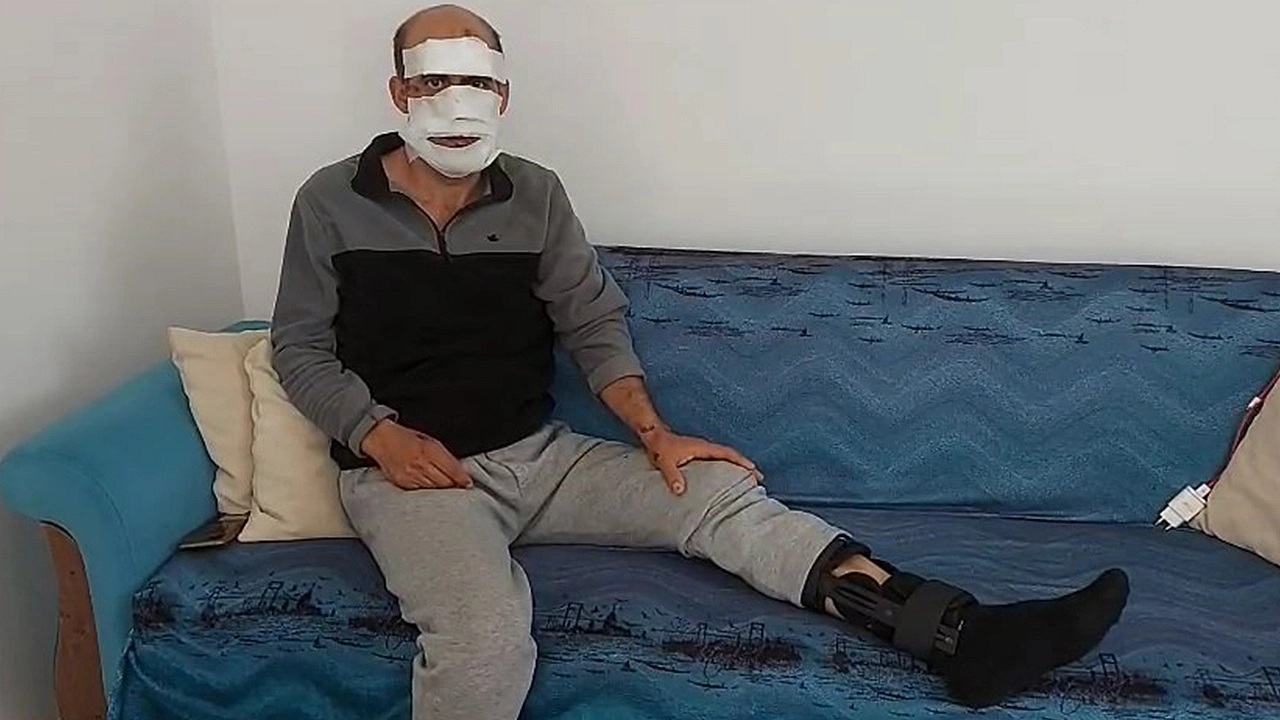 Elazığ'da skandal: Eniştesine araçla çarpıp kaçtı!