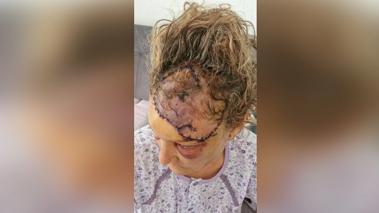 Patronun köpeği dehşet saçtı: Vücuduna 80 dikiş atılan kadın koruma ölümden döndü