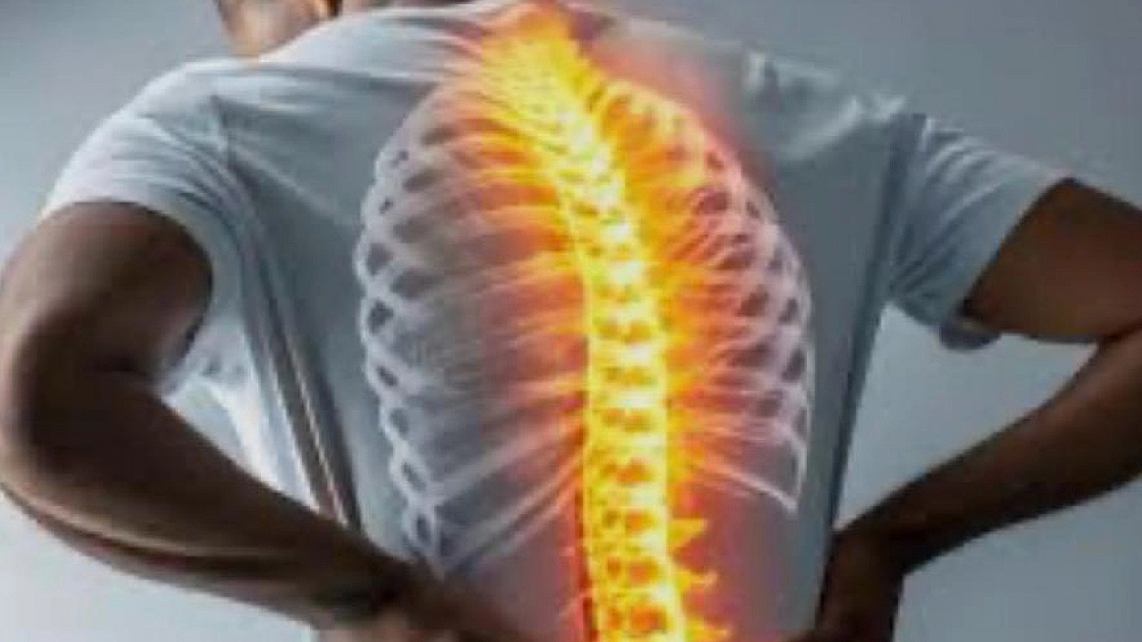 Ankilozan Spondilitte egzersiz ve sigarasız yaşam uyarısı
