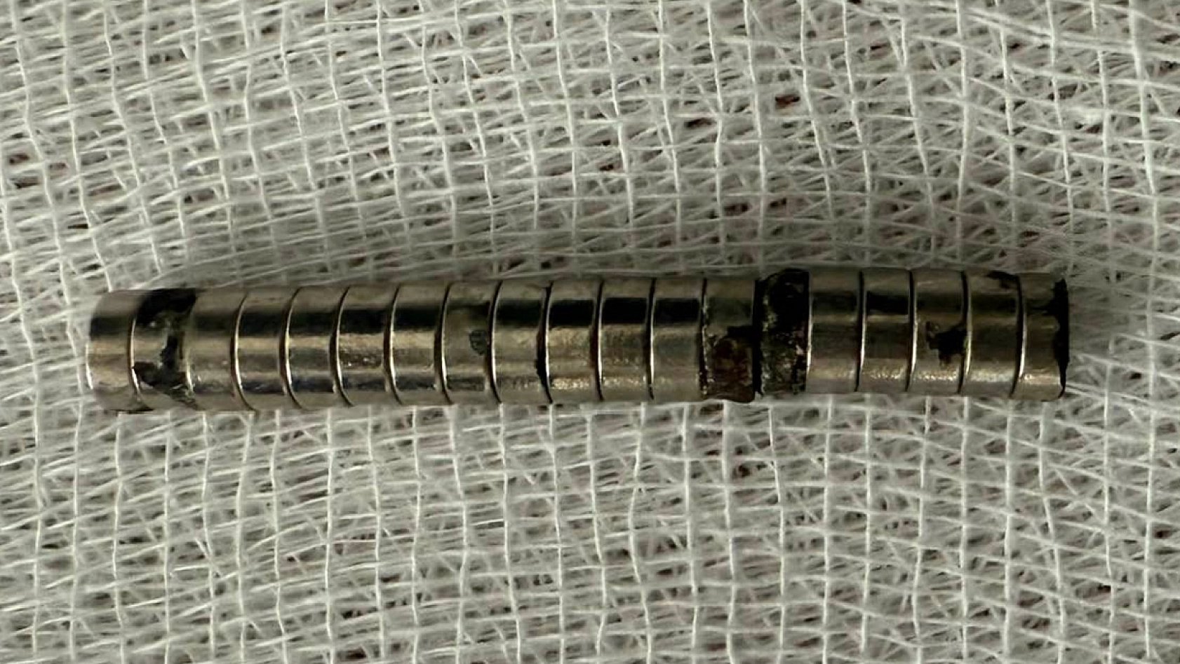 Elazığ'da 3 yaşındaki çocuğun midesinden çıkanlar şok etti