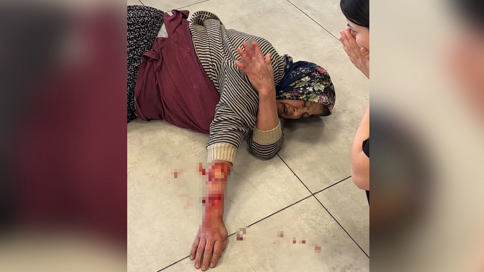 Dinlenme tesisinde feci saldırı: Kadının kolu koptu