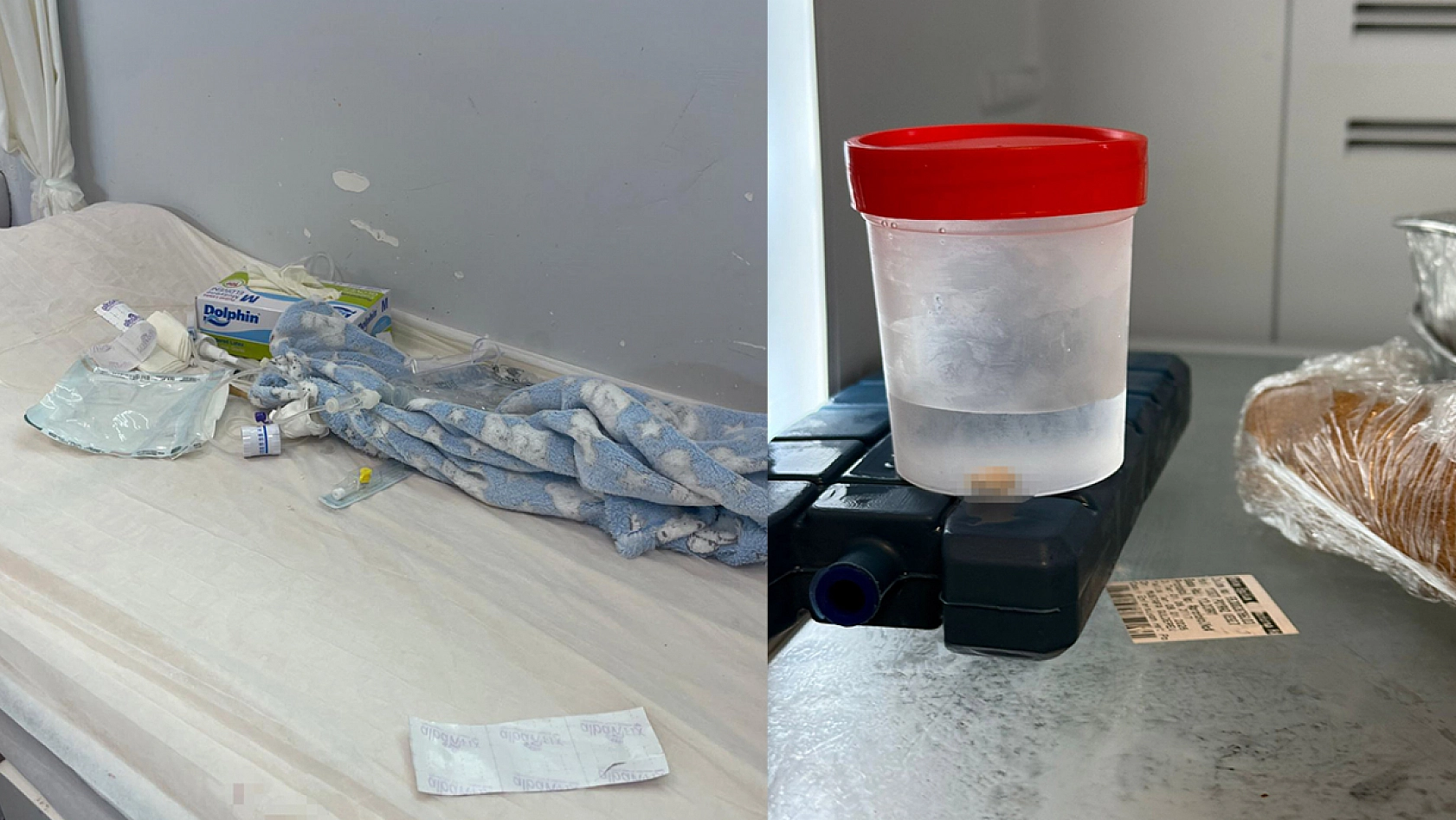 5 aylık bebeğin parmağı serum çıkarılırken koptu
