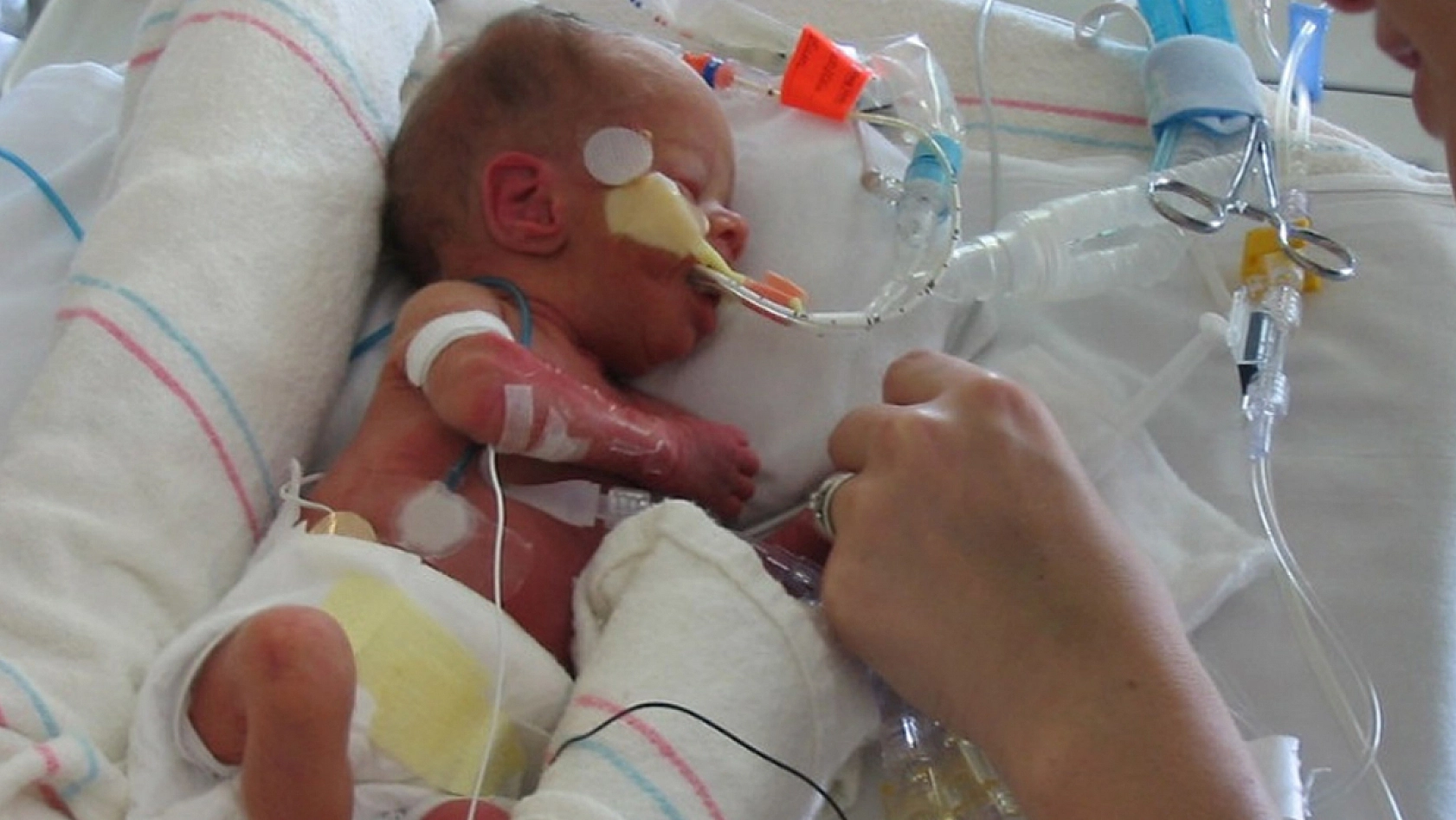 Gebelikler erken mi sonlandırıldı? Hastaneye kapatma