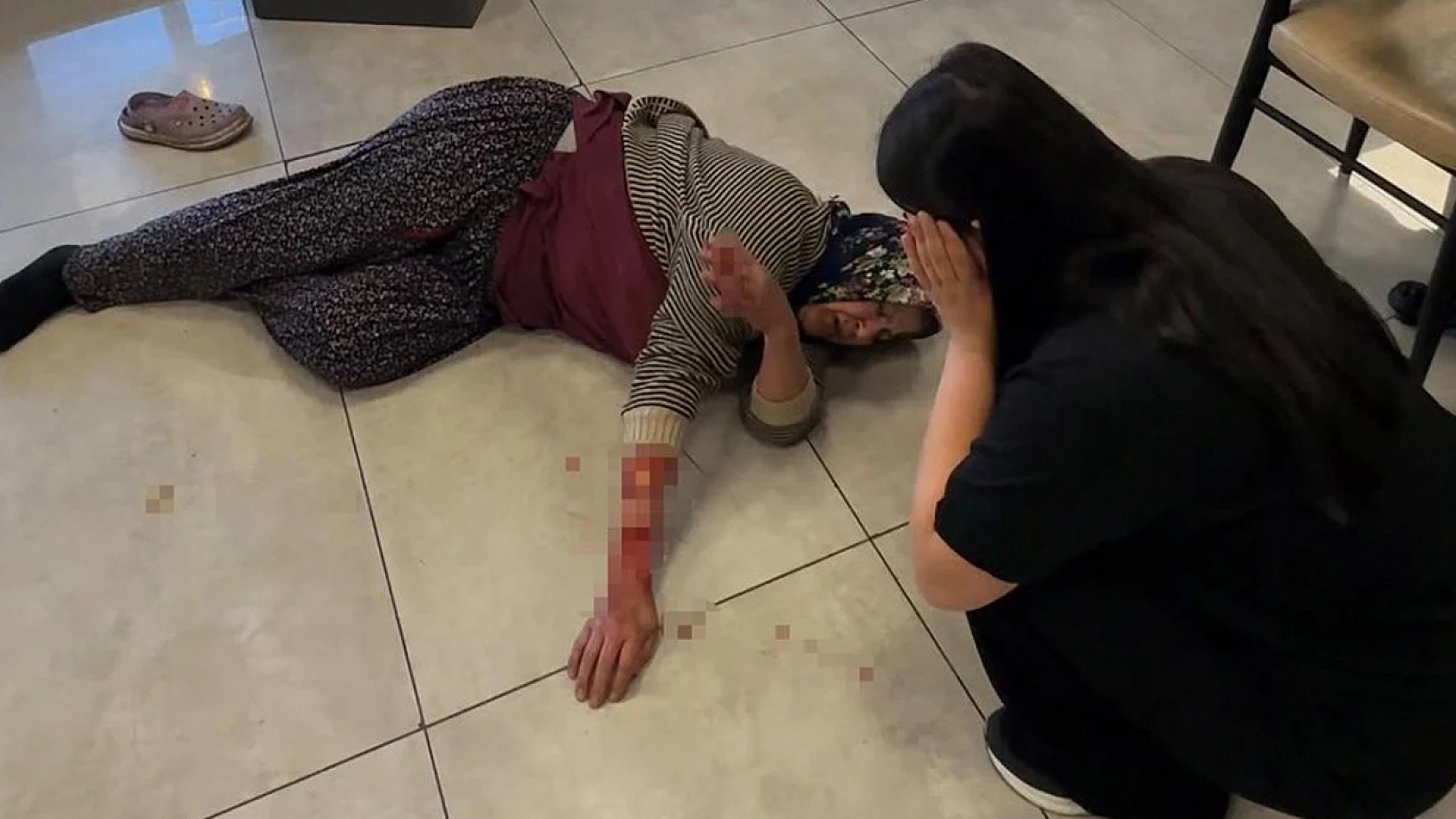Dinlenme tesisinde feci saldırı: Kadının kolu koptu