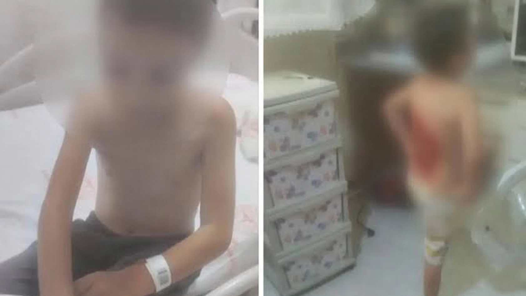 12 yaşındaki çocuğun sırtına kolonya döküp yaktılar