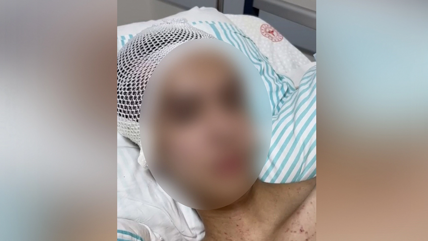 Tacize direndiği iddiasıyla başından vurulan çocuk felç kaldı