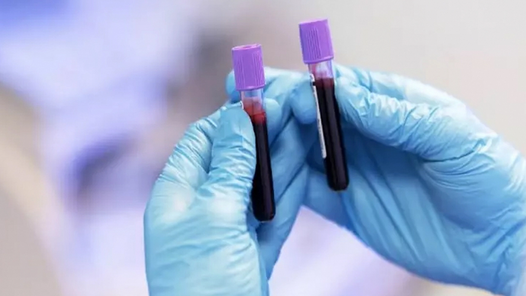 Kansere en yatkın kan grupları belli oldu!