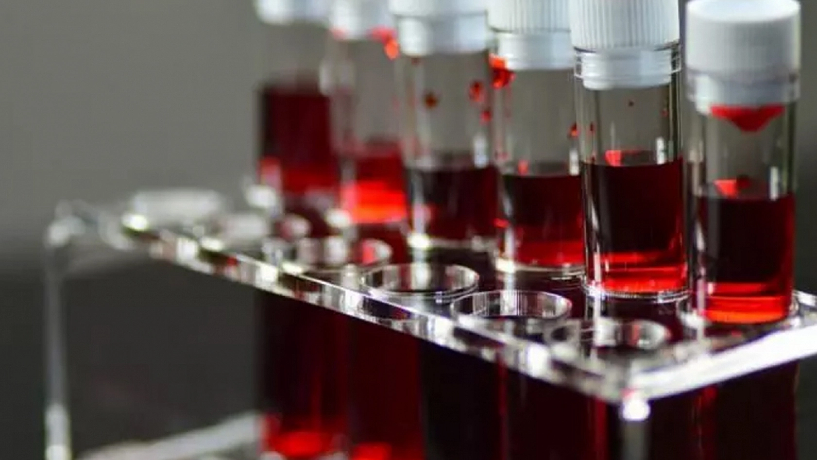 Kansere en yatkın kan grupları belli oldu!