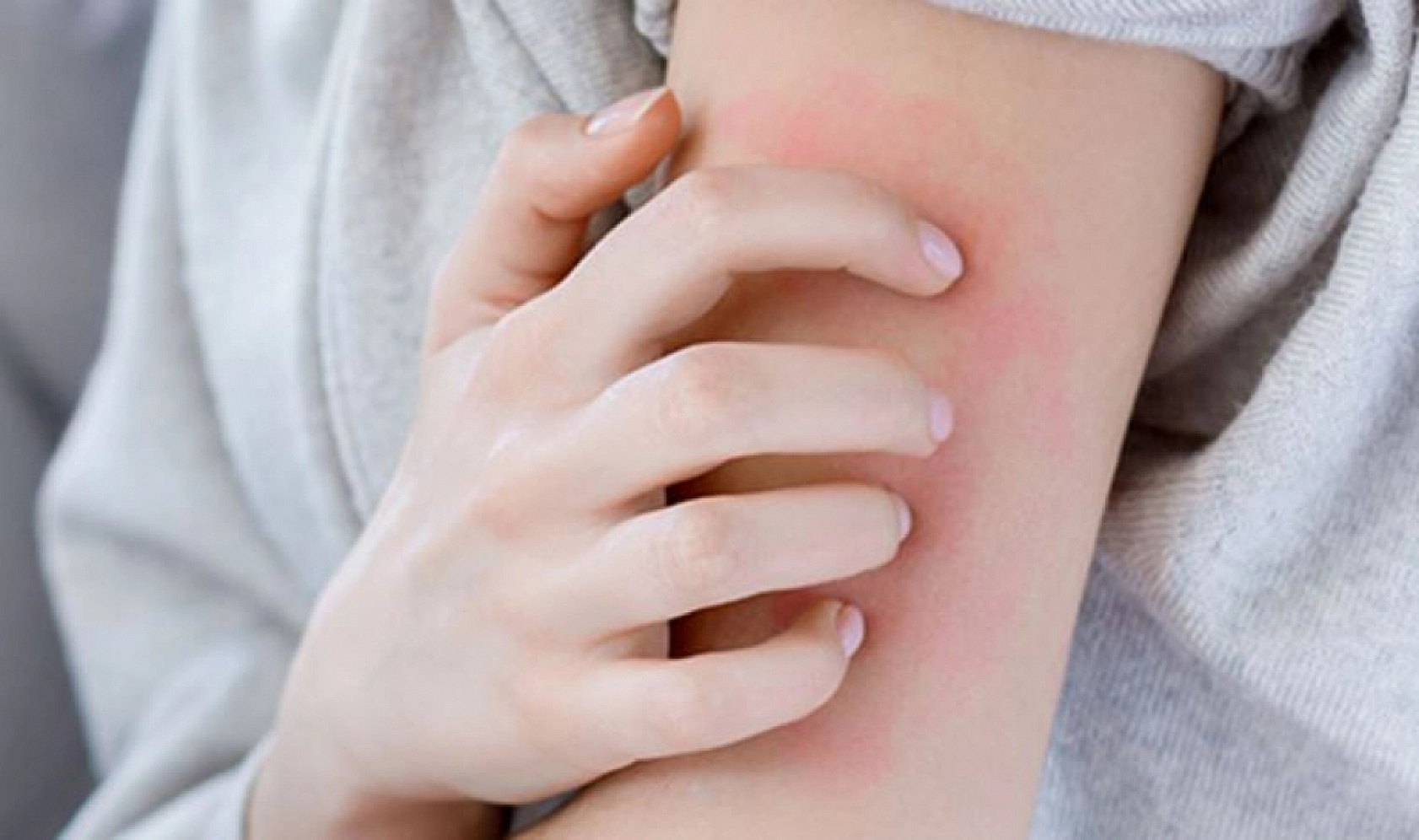 Salgın gibi ilerliyor: Uzmanı uyardı... Bunları kesinlikle yapmamalısınız!