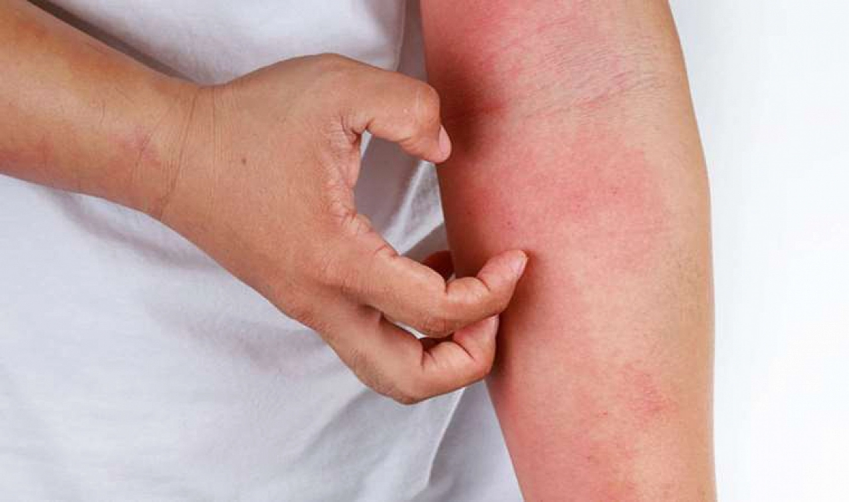 Salgın gibi ilerliyor: Uzmanı uyardı... Bunları kesinlikle yapmamalısınız!