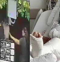 3 çocuk annesi kadının kolu ve bacağını kırdılar!