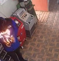 Elazığ'da ilginç anlar: Çakmağı çakınca yüzü alevlerin arasında kaldı