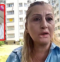Estetik faciası: Güzelleşmek isterken dudağını kaybetti