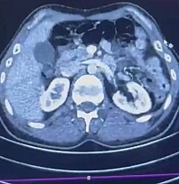 Midelerinde uyuşturucu taşıyan şüpheliler yakalandı