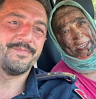 Yürek ısıtan mücadele: koah hastası Hanife teyze, orman yangınına koştu