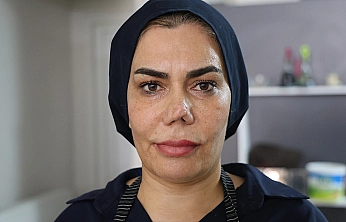 Elazığ'da 4 burun ameliyat sonrası hayatı kabusa döndü