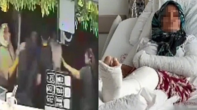 3 çocuk annesi kadının kolu ve bacağını kırdılar!
