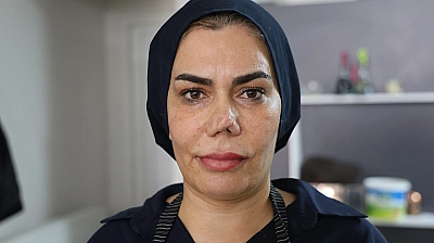 Elazığ'da 4 burun ameliyat sonrası hayatı kabusa döndü