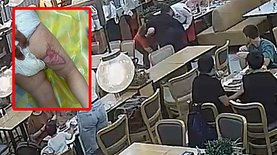Tereyağı şovu kabusa döndü: 2 yaşındaki bebek ağır yaralandı