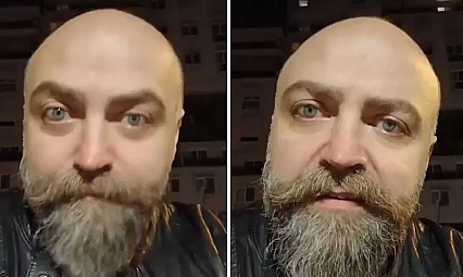 Saçsız adam isyan etti! Berbere ödediği ücret dudak uçuklattı