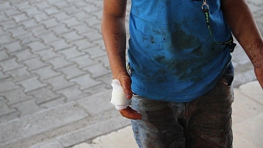 Babasına kurban kesmek için yardım eden çocuk elini kesti