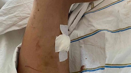 Doktor sevgilisinin evinde dehşeti yaşayan genç kadın 2 saat boyunca darp edildi, 5 yerinden bıçaklandı