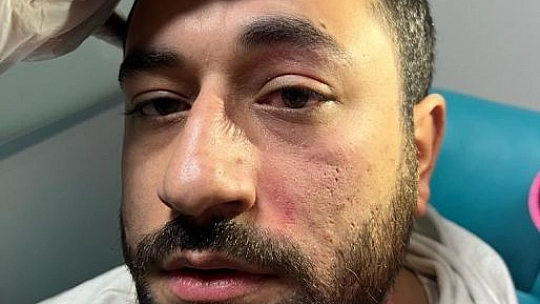 Elazığ'da doktoru darp eden şahıs serbest bırakıldı
