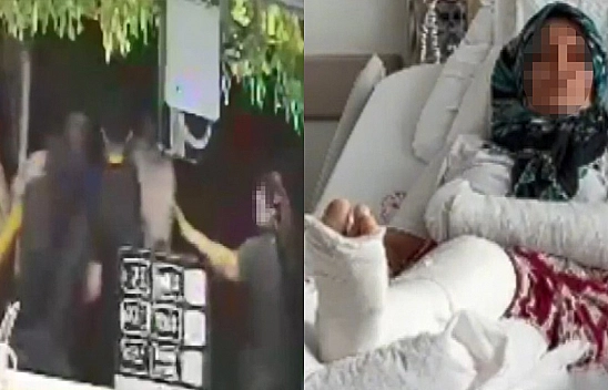 3 çocuk annesi kadının kolu ve bacağını kırdılar!