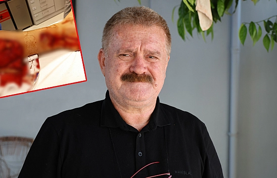 Çin Aslanı Evdeki Diğer Köpekten Sahibini Kıskanarak Bacağını Parçaladı