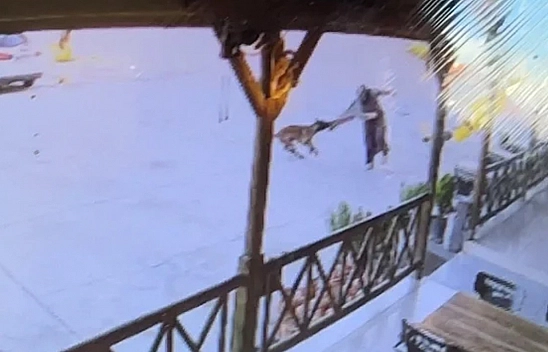 Dinlenme tesisinde feci saldırı: Kadının kolu koptu