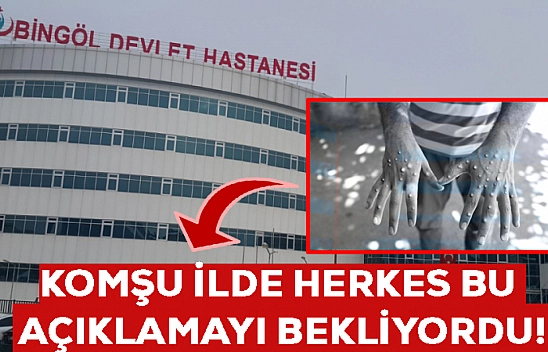Elazığ'a komşu olan ilde Maymun Çiçeği Virüsü açıklaması! Herkes diken üzerinde bekledi… İşte gelen açıklama