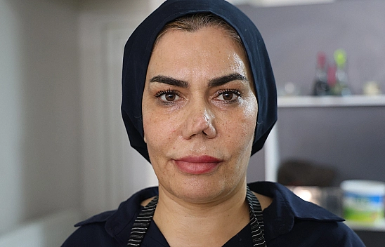 Elazığ'da 4 burun ameliyat sonrası hayatı kabusa döndü