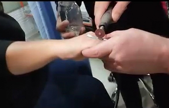 Elazığ'da Parmağa Sıkışan  Yüzüğü İtfaiye Ekipleri Çıkardı