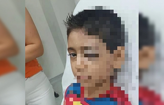 Elazığ'da skandal: Polisin Dövdüğü Çocuk Ağır Yaralandı
