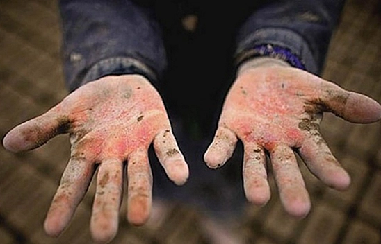 Elazığ'da Yasadışı ve Tehlikeli Yolculuk