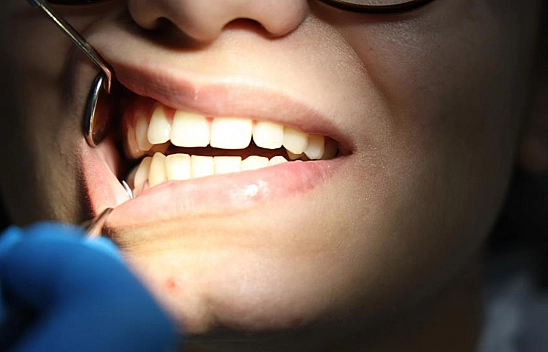 Elazığlı Vatandaşların Stresi Dişlerinden Belli Oluyor