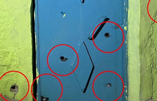 Evinin Önünde Oturan Kadın Yaralandı