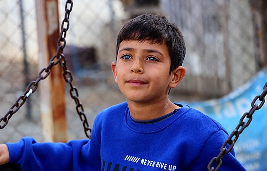 Hayata Çift renk Bakıyor, Görenler Hayrete Düşüyor