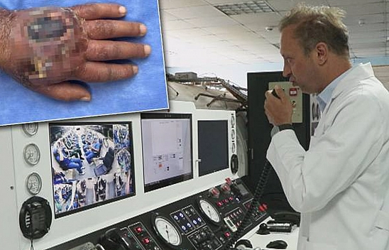 Hırsız ısırığı az daha kolundan ediyordu!