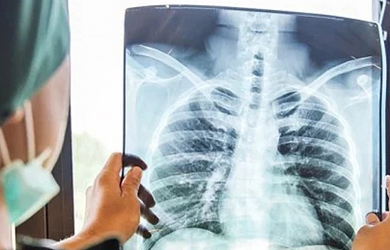 Ne Korona, Ne Grip, Ne De Nezle... İşte Yeni Kabusumuzun Belirtileri