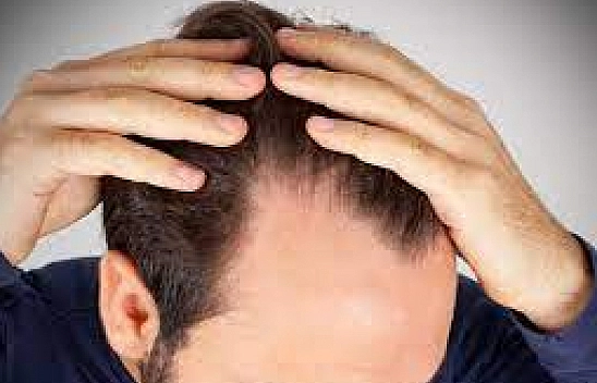 Saç dökülmesine doğal çözüm: İşte saç dökülmesine iyi gelen 5 bitki