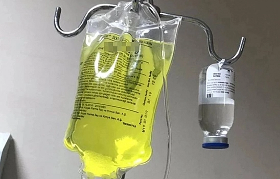 Sağlık Bakanlığı'ndan kritik 'Sarı serum' açıklaması!