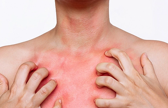 Salgın gibi ilerliyor: Uzmanı uyardı... Bunları kesinlikle yapmamalısınız!