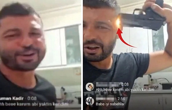 Sosyal Medya Çılgınlığı: Canlı Yayın Sırasında Yanlışlıkla Kafasına Sıktı!