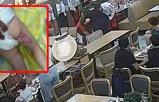 Tereyağı şovu kabusa döndü: 2 yaşındaki bebek ağır yaralandı