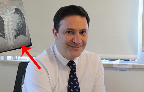  Yeni Salgın Alarm Veriyor Elazığlılar Dikkat!